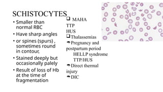 SCHISTOCYTES
• Smaller than
normal RBC
• Have sharp angles
• or spines (spurs) ,
sometimes round
in contour,
• Stained deeply but
occasionally palely
• Result of loss of Hb
at the time of
fragmentation
TTP
HUS
Thalassemias
Pregnancy and
postpartum period
HELLP syndrome
TTP/HUS
Direct thermal
injury
DIC
 MAHA
 