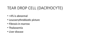 TEAR DROP CELL (DACRYOCYTE)
• >4% is abnormal
• Leucoerythroblastic picture
• Fibrosis in marrow
• Thalassemia
• Liver disease
 