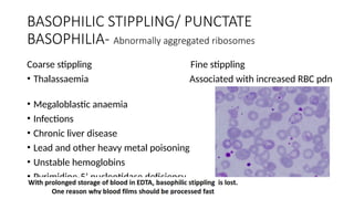 BASOPHILIC STIPPLING/ PUNCTATE
BASOPHILIA- Abnormally aggregated ribosomes
Coarse stippling Fine stippling
• Thalassaemia Associated with increased RBC pdn
• Megaloblastic anaemia
• Infections
• Chronic liver disease
• Lead and other heavy metal poisoning
• Unstable hemoglobins
• Pyrimidine-5’ nucleotidase deficiency
 