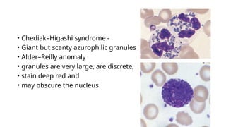 • Chediak–Higashi syndrome -
• Giant but scanty azurophilic granules
• Alder–Reilly anomaly
• granules are very large, are discrete,
• stain deep red and
• may obscure the nucleus
 