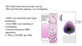 Best field-Area between body and tail
Rbcs just become separate / no overlapping
1.RBCs are uniformly and singly
distributed
2.Few RBCs are touching or
overlapping
3.Normal biconcave RBC
appearance
4. 200 to 250 RBC per 100x
 