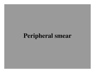 Peripheral smear
 