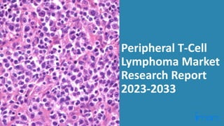 Peripheral T-Cell
Lymphoma Market
Research Report
2023-2033
 