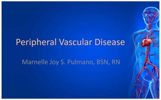 Peripheral Vascular Disease
 Marnelle Joy S. Pulmano, BSN, RN
 