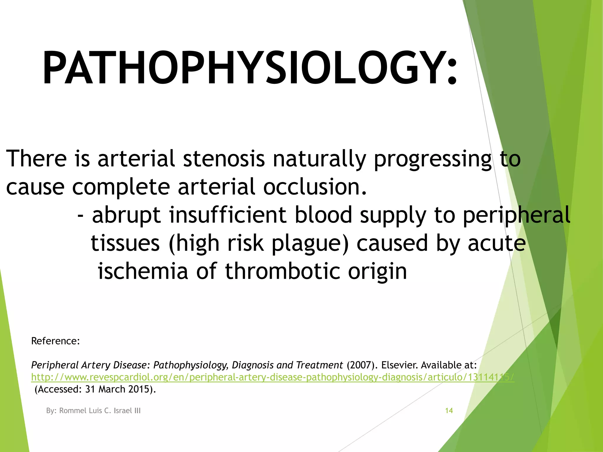 Peripheral Vascular Disease | PPTX