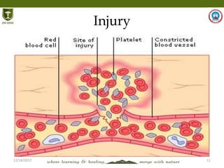 12/14/2017 11
Injury
 