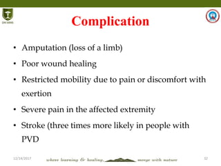 12/14/2017 32
Complication
• Amputation (loss of a limb)
• Poor wound healing
• Restricted mobility due to pain or discomfort with
exertion
• Severe pain in the affected extremity
• Stroke (three times more likely in people with
PVD
 
