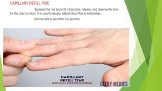 Peripheral vascular examination (2).pptx
