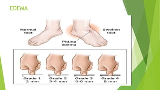 Peripheral vascular examination (2).pptx