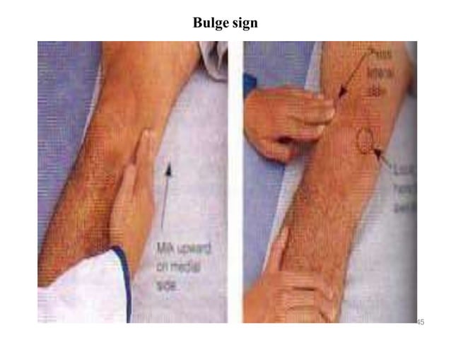 Peripheral Vascular _Musculoskeletal system.pptx