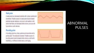 Unstable Pulse PERIPHERAL VASCULAR SYSTEM.pptx