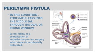 PERIPHERAL VESTIBULAR DISORDERS RAX PPT.pptx