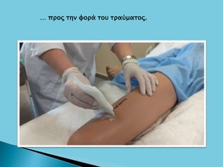 … προς την φορά του τραύματος.
 