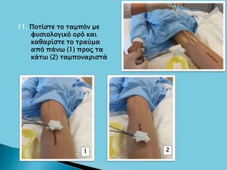 11. Ποτίστε το ταμπόν με
φυσιολογικό ορό και
καθαρίστε το τραύμα
από πάνω (1) προς τα
κάτω (2) ταμποναριστά
1 2
 