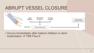 Periprocedural Myocardial infarction in contemporary Practise.pptx