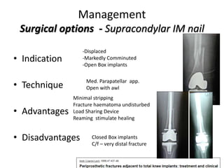 Management
Surgical options - Supracondylar IM nail
• Indication
• Technique
• Advantages
• Disadvantages
-Displaced
-Markedly Comminuted
-Open Box implants
Med. Parapatellar app.
Open with awl
Minimal stripping
Fracture haematoma undisturbed
Load Sharing Device
Reaming stimulate healing
Closed Box implants
C/f – very distal fracture
 