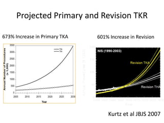 Projected Primary and Revision TKR
673% Increase in Primary TKA
Kurtz et al JBJS 2007
601% Increase in Revision
 