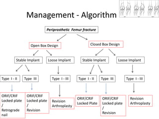Management - Algorithm
Periprosthetic Femur fracture
Open Box Design Closed Box Design
Stable Implant Loose Implant Stable Implant Loose Implant
Type I - II Type III Type I - III Type I - II Type III Type I - III
ORIF/CRIF
Locked plate
/
Retrograde
nail
ORIF/CRIF
Locked plate
/
Revision
Revision
Arthroplasty
Revision
Arthroplasty
ORIF/CRIF
Locked Plate
ORIF/CRIF
Locked plate
/
Revision
 
