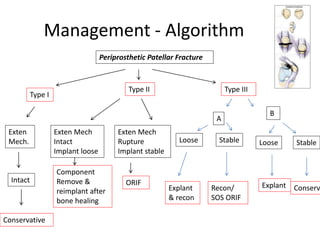 Management - Algorithm
Periprosthetic Patellar Fracture
Type I
Type II Type III
Exten
Mech.
Exten Mech
Intact
Implant loose
Intact
Conservative
Component
Remove &
reimplant after
bone healing
Exten Mech
Rupture
Implant stable
ORIF
A
B
Loose Stable Loose Stable
Explant
& recon
Recon/
SOS ORIF
Explant Conserv
 