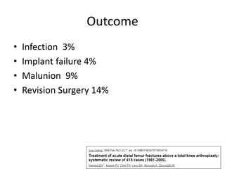 Outcome
• Infection 3%
• Implant failure 4%
• Malunion 9%
• Revision Surgery 14%
 