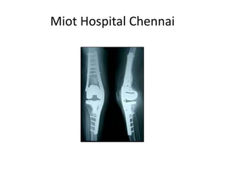 Miot Hospital Chennai
 
