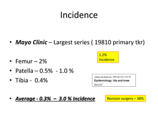 Incidence
• Mayo Clinic – Largest series ( 19810 primary tkr)
• Femur – 2%
• Patella – 0.5% - 1.0 %
• Tibia - 0.4%
• Average - 0.3% – 3.0 % Incidence
1.2%
Incidence
Revision surgery – 38%
 