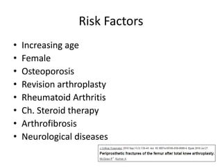 Risk Factors
• Increasing age
• Female
• Osteoporosis
• Revision arthroplasty
• Rheumatoid Arthritis
• Ch. Steroid therapy
• Arthrofibrosis
• Neurological diseases
 