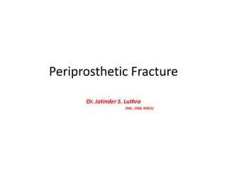 Periprosthetic Fracture
Dr. Jatinder S. Luthra
(MS , DNB, MRCS)
 