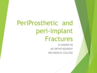 PeriProsthetic and
peri-implant
Fractures
Dr.ADARSH RS
MS ORTHO RESIDENT
MES MEDICAL COLLEGE
 