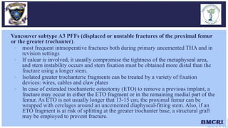 periprosthetic fracture around hio prosthesis | PDF