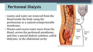 Peritoneal Dialysis
• wastes and water are removed from the
blood inside the body using the
peritoneum as a natural semipermeable
membrane.
• Wastes and excess water move from the
blood, across the peritoneal membrane,
and into a special dialysis solution, called
dialysate, in the abdominal cavity
 