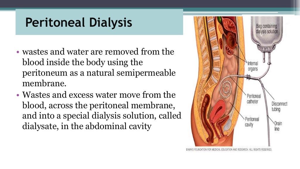 Peritoneal dialysis