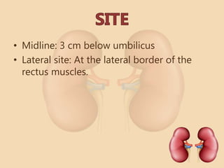 • Midline: 3 cm below umbilicus
• Lateral site: At the lateral border of the
rectus muscles.
 