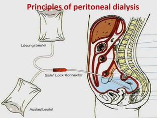 Principles of peritoneal dialysis
 
