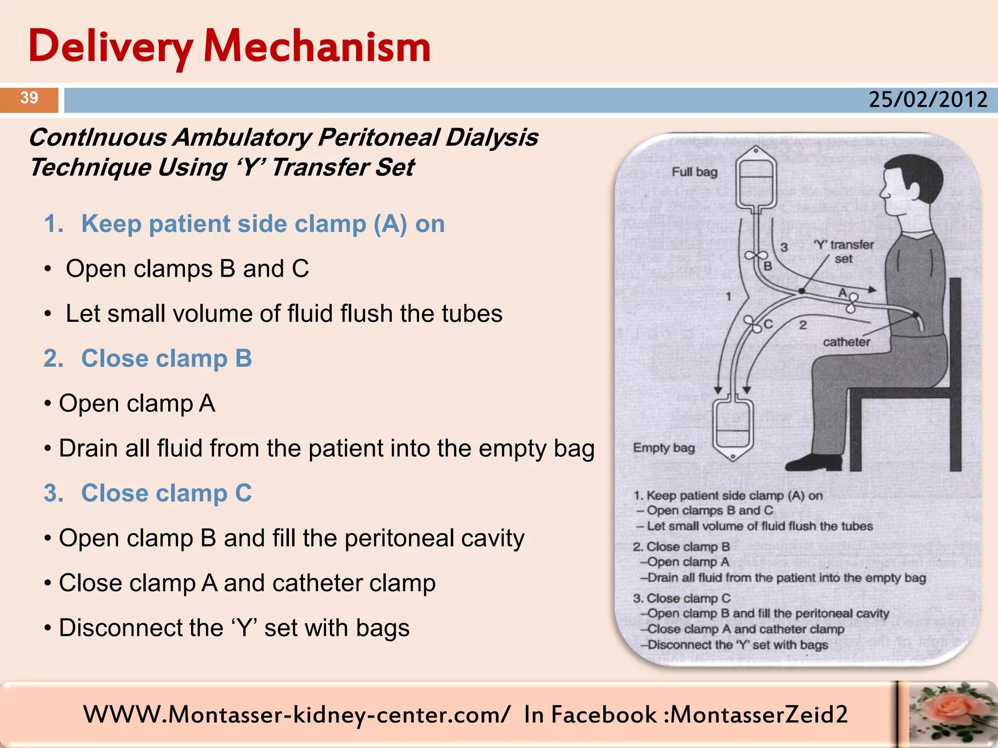 WWW.Montasser-kidney-center.com/ In Facebook :MontasserZeid2
Delivery Mechanism
39
Contlnuous Ambulatory Peritoneal Dialysis
Technique Using ‘Y’ Transfer Set
1. Keep patient side clamp (A) on
• Open clamps B and C
• Let small volume of fluid flush the tubes
2. Close clamp B
• Open clamp A
• Drain all fluid from the patient into the empty bag
3. Close clamp C
• Open clamp B and fill the peritoneal cavity
• Close clamp A and catheter clamp
• Disconnect the ‘Y’ set with bags
25/02/2012
 