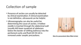 Collection of sample
• Presence of ascites can usually be detected
by clinical examination; if clinical examination
is not definitive, ultrasound can be helpful.
• Ultrasonography can also be useful for
determining the cause of ascites. A hollow
needle is inserted through the abdominal wall
(usually left lower quadrant of abdomen
below the border of shifting dullness) into the
peritoneal cavity and fluid (20-50 ml) is
removed under aseptic precautions. Sites for paracentesis (blue filled circles)
 