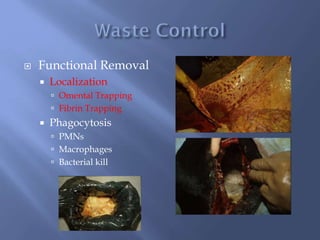  Functional Removal
 Localization
 Omental Trapping
 Fibrin Trapping
 Phagocytosis
 PMNs
 Macrophages
 Bacterial kill
 