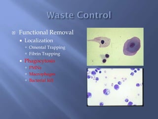  Functional Removal
 Localization
 Omental Trapping
 Fibrin Trapping
 Phagocytosis
 PMNs
 Macrophages
 Bacterial kill
 
