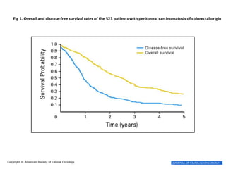 Fig 1. Overall and disease-free survival rates of the 523 patients with peritoneal carcinomatosis of colorectal origin 
Elias, D. et al. J Clin Oncol; 28:63-68 2010 
Copyright © American Society of Clinical Oncology 
 