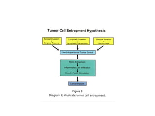Peritoneal karsinomatosiz, HIPEC EUS