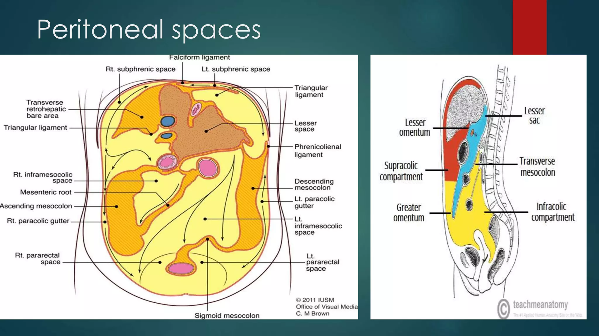 Anatomy Of Peritoneal Spaces PPTX