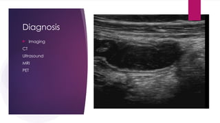 Diagnosis
 Imaging
CT
Ultrasound
MRI
PET
 