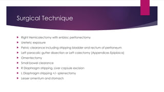 Surgical Technique
 Right Hemicolectomy with enbloc peritonectomy
 Ureteric exposure
 Pelvic clearance including stripping bladder and rectum of peritoneum
 Left paracolic gutter dissection or Left colectomy (Appendices Epiploica)
 Omentectomy
 Small bowel clearance
 R Diaphragm stripping, Liver capsule excision
 L Diaphragm stripping +/- splenectomy
 Lesser omentum and stomach
 