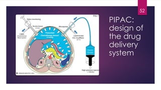 PIPAC:
design of
the drug
delivery
system
52
 
