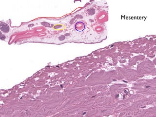 Mesentery

 