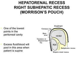 HEPATORENAL RECESS
RIGHT SUBHEPATIC RECESS
(MORRISON’S POUCH)

• One of the lowest
points in the
peritoneal cavity

• Excess fluid/blood will
pool in this area when
patient is supine

 