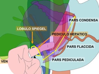 PARS CONDENSA

       LOBULO SPIEGEL
                        PEDICULO HEPATICO


                               PARS FLACCIDA



VENA CAVA               PARS PEDICULADA

            BULBO
 