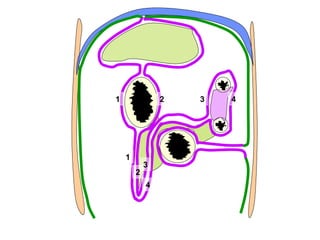 1               2   3   4




    1
            3
        2
            4
 