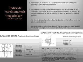 Índice de
carcinomatosis
“Sugarbaker”
SERAM 2014 / S-0238
 