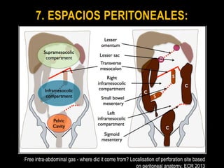 Peritoneo anatomia rm | PPTX
